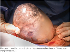 https://www.europeanjournalofmidwifery.eu/f/fulltexts/223962/EJM-10-24-g002_min.jpg