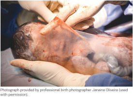 https://www.europeanjournalofmidwifery.eu/f/fulltexts/223962/EJM-10-24-g003_min.jpg